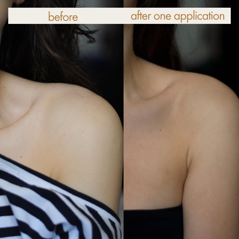 Person, Schulter, Erwachsener, Weiblich, Frau