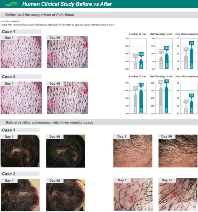 tophair-clinical-study
