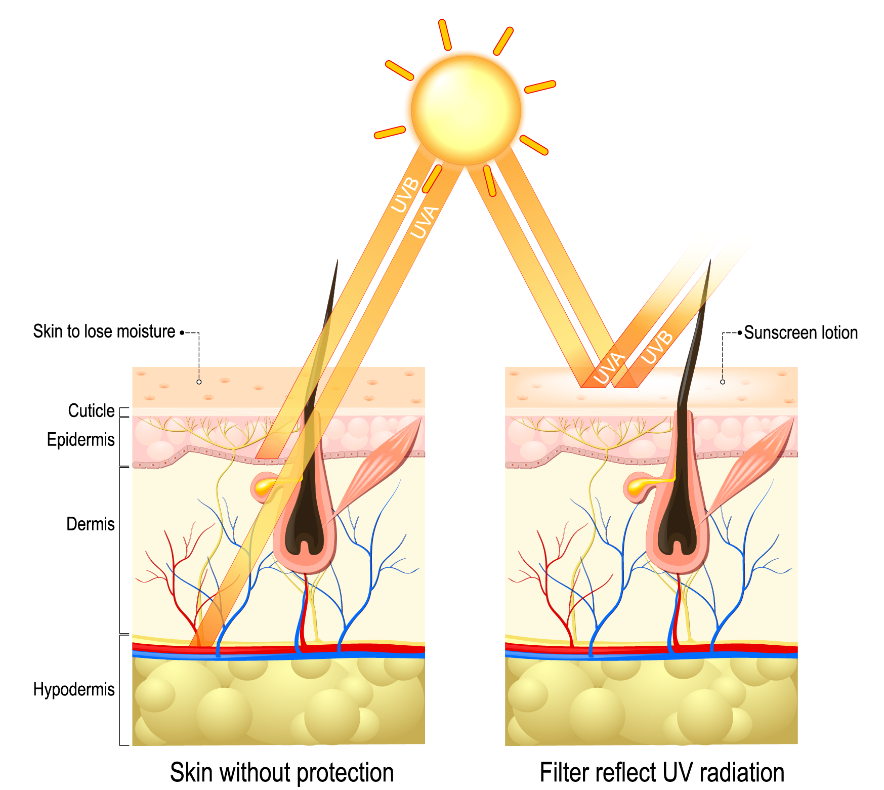 UVdamageWbMJxdpvRPbx2