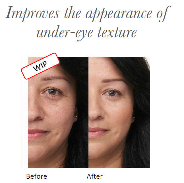 vorhernachhersofortmitenlightenplus