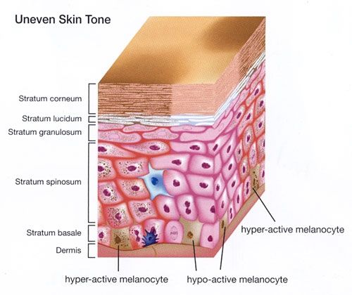 Belcol-Hexyl-uneven-skin-tone-580-800