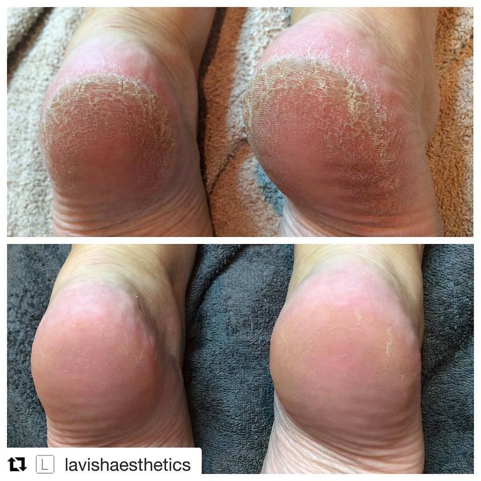 17498531_983624821774136_5688467294936383222_n-copy