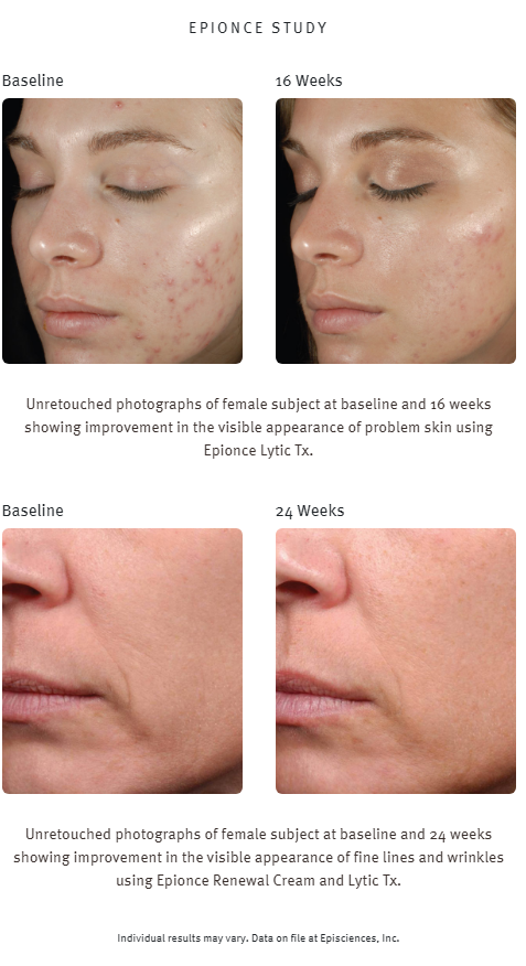 Lytic TX 40ml Tagescreme gegen Unreinheiten / Akne Lytic TX 40ml Tagescreme gegen Unreinheiten / Akne