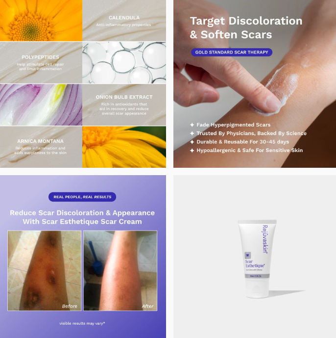 Scar Esthetique Narbencreme mit Silikon: Natürliche Inhaltsstoffe wie Calendula und Zwiebelextrakt. Eine Hand trägt die Creme auf eine Narbe am Arm auf. Vorher-Nachher-Bilder zeigen Aufhellung und Glättung einer Narbe am Bein.