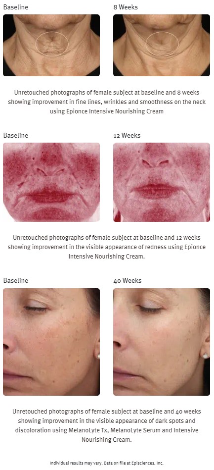 beforeandafterINTENSEnourisingCream