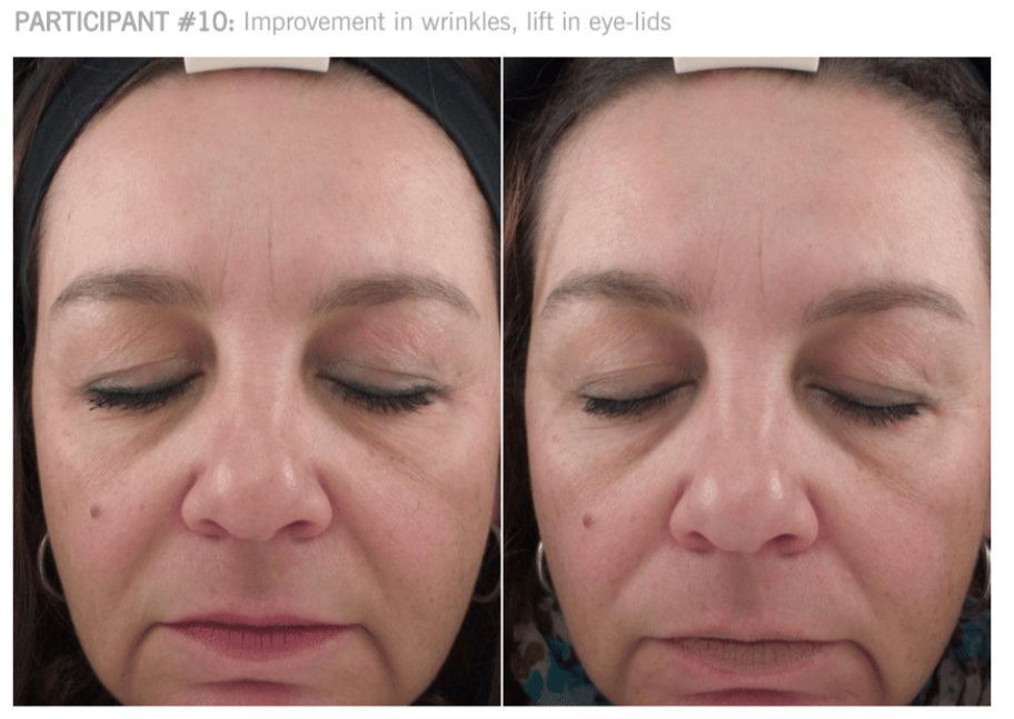 12weeksconditioningbalmparticipant10