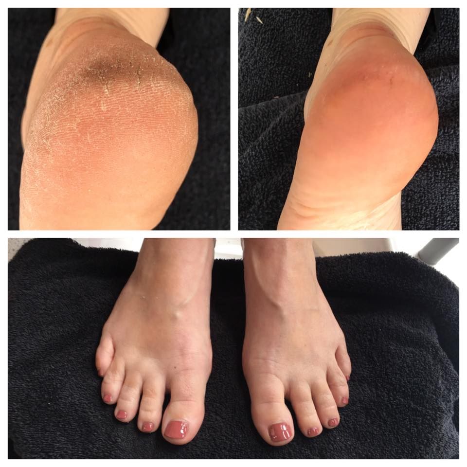 12974400_1690163847913580_5416480152687749068_n