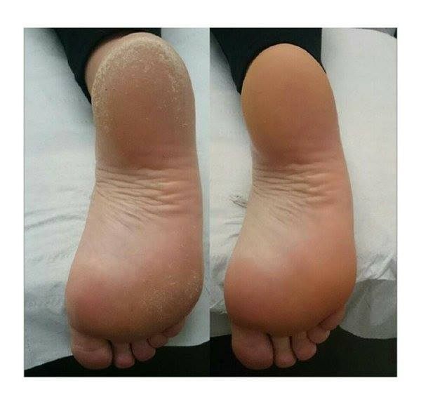 23518811_341156043024135_6105926866927036185_n