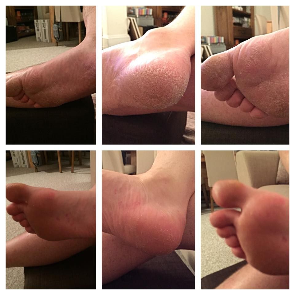 11037216_10152905213597881_8608984026068157695_n