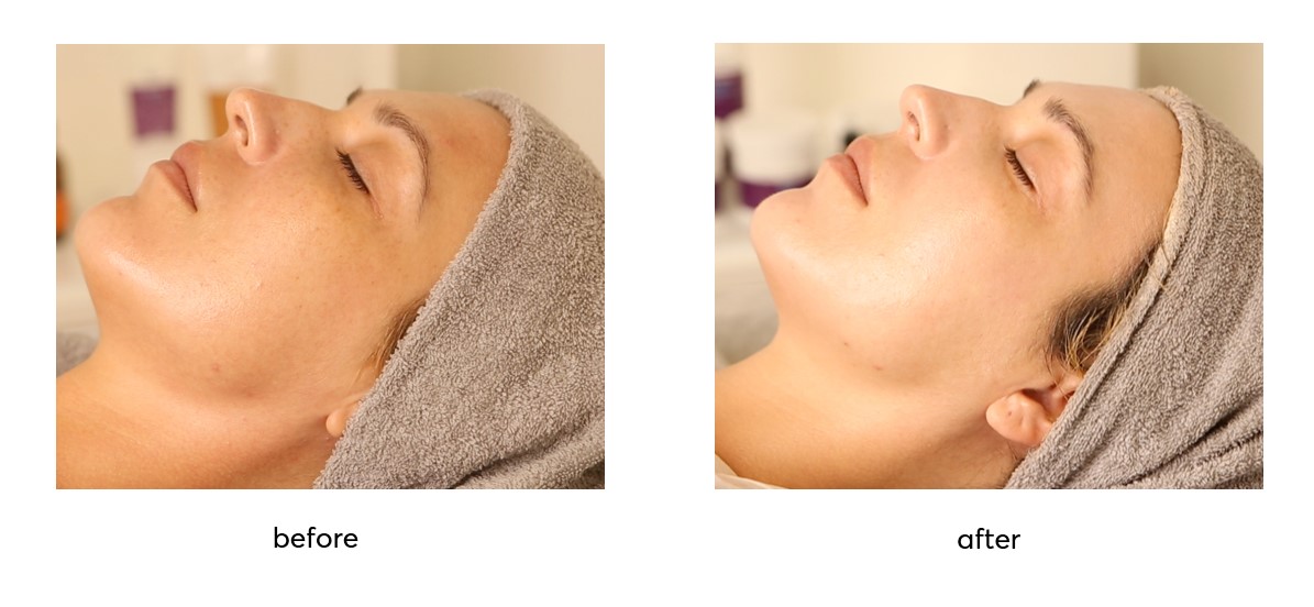 Apocalypsis-before-after