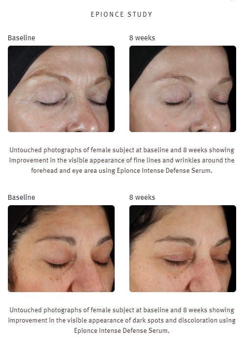 Epionce-Anti-Aging-beforeafter-jpg