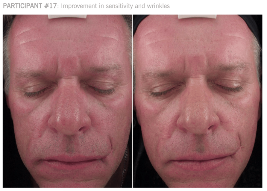 12weeksconditioningbalmandexyegelparticipant12