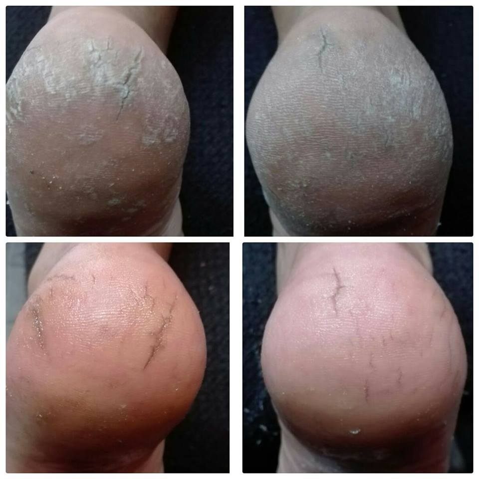 18198209_1199139383542013_2017274855273051988_n