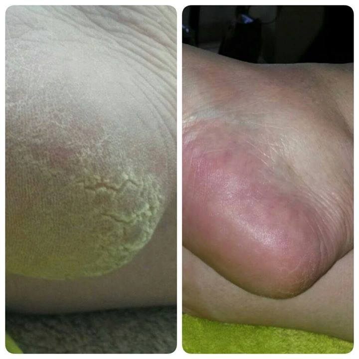 22528099_1743560039045245_7278131588363647473_n