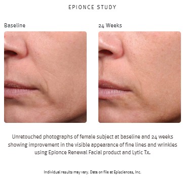 beforeafterrenewallotion