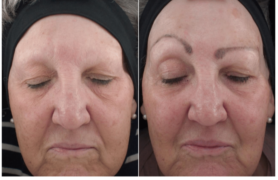 12weeksconditioningbalmandeyegel