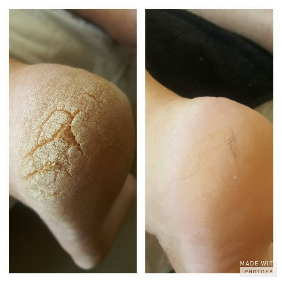 18341777_1440819935981147_7634412004115848657_n