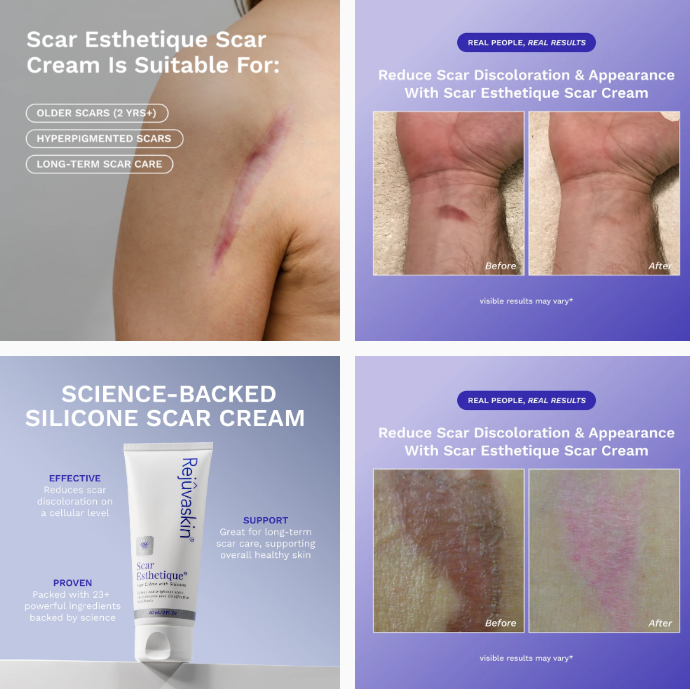 Das Bild zeigt die Scar Esthetique Narbencreme und ihre Wirkung: eine Narbe am Oberarm, zwei Vorher-Nachher-Vergleiche an Handgelenk und Bein (nach Behandlung heller, glatter) sowie die Tube der silikonbasierten Creme.