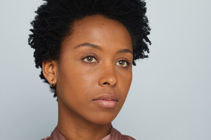 IC_LashFixation_Angled-Ieda-After_0012-720x480-1cf2be5d-e044-4cbd-b2b8-400134c7757f