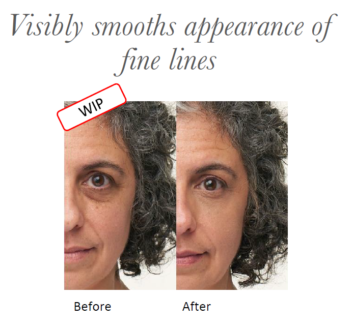 vorhernachhersofortmitenlightenplusFINELINES