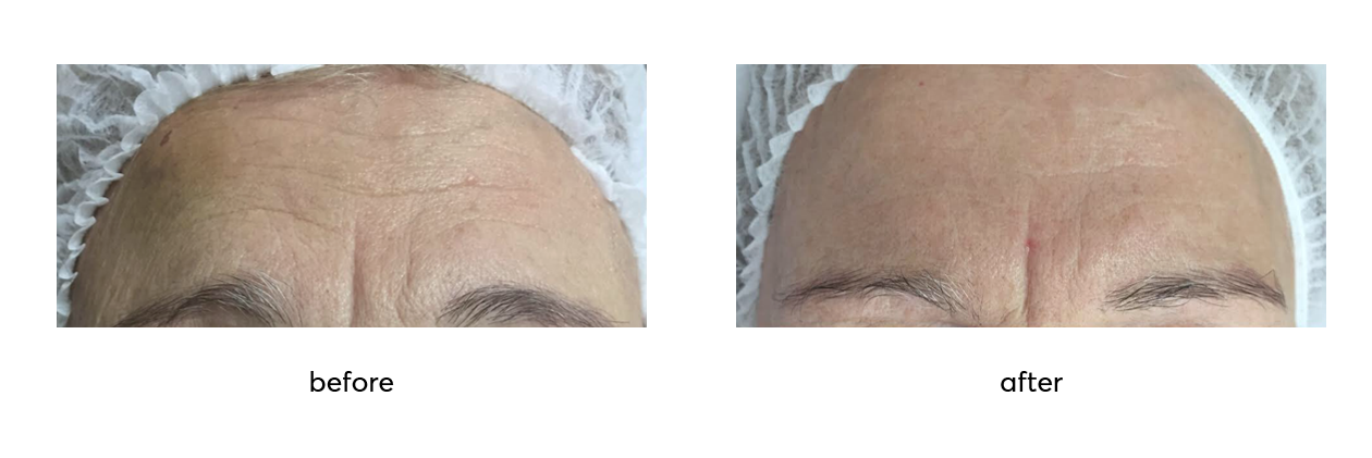 Repair-before-after-5-sessions