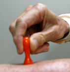 stamp Medical Focus CIT Stamp 1.5mm