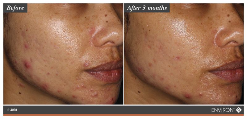 asianskin90days